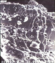 卵殻カルシウム（×８０００）.jpg